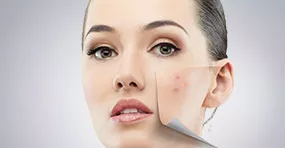 Климактерический синдром.